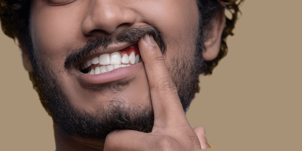 Hombre con las encías sangrando al despertar