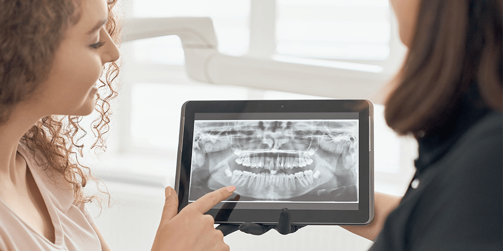 cDiagnostico ATM - bruxismo - Clínica dental Soria - Salamanca