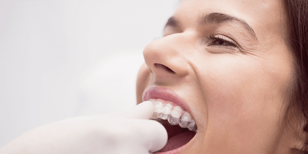 Mujer probando su nuevo protector de dientes y encias