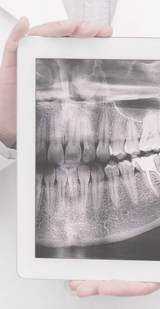 Dentista enseñando una radiografía de una boca