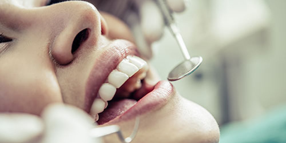 Dentista realizando una revisión de caries