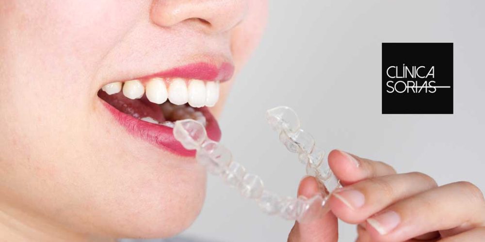 Boca abierta con síntomas de bruxismo