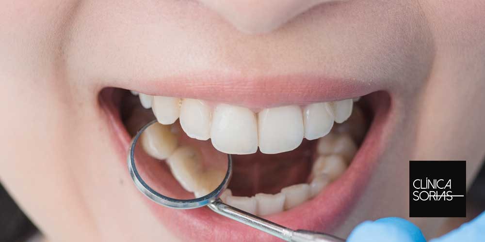 Dentista revisando unos dientes con un espejo dental