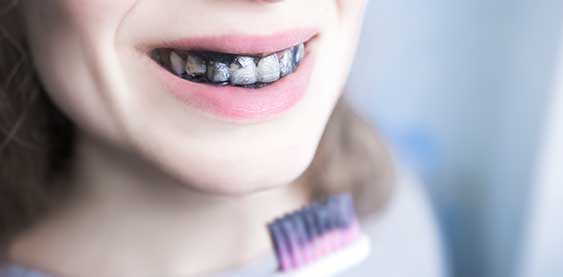 Niña con carbón activo en los dientes sonriendo