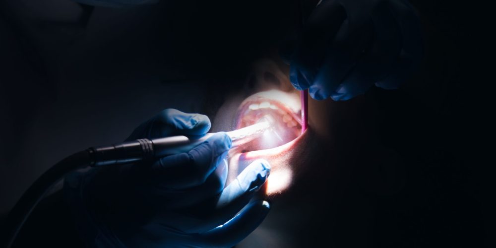 Dentista realizando una linea de incisión