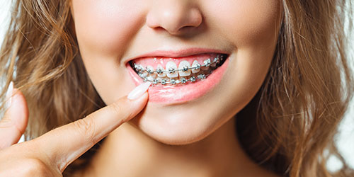 Chica con brackets sonriendo