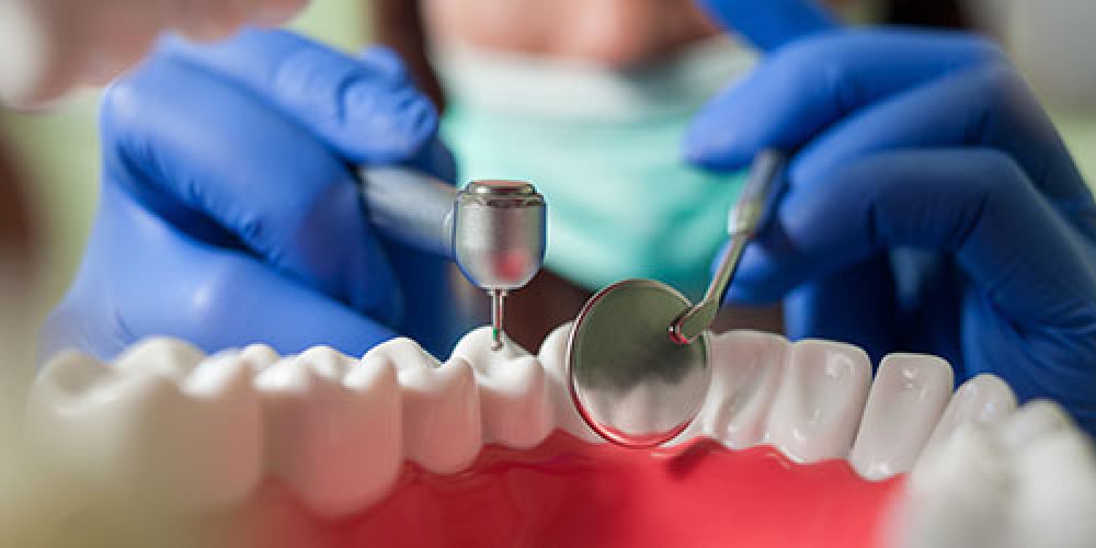 Dentista realizando una endodoncia