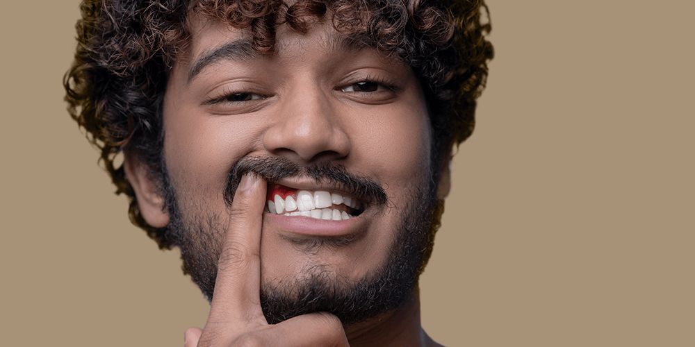 Hombre joven con gingivitis