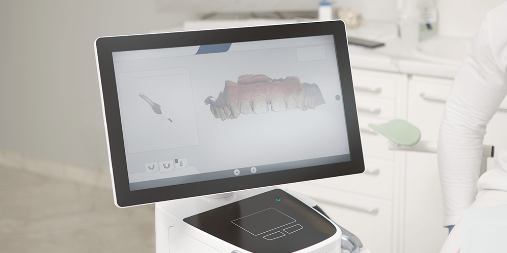 3d Escaner - Clínica Dental - Salamanca - Clínica Soria